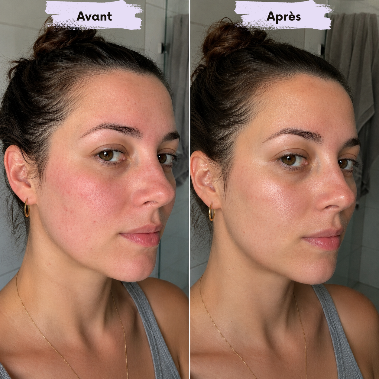 Boite de 5 masques hydrogel - Redness Rescue